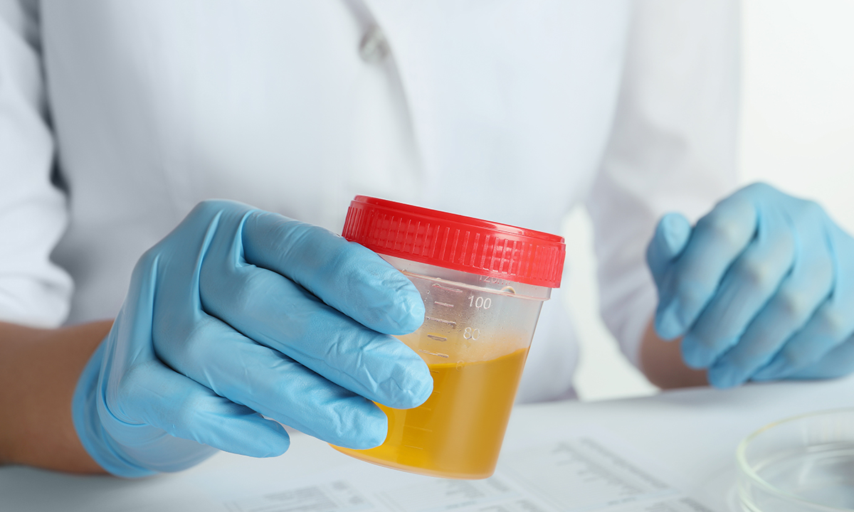 Datcs Training Courses Urine