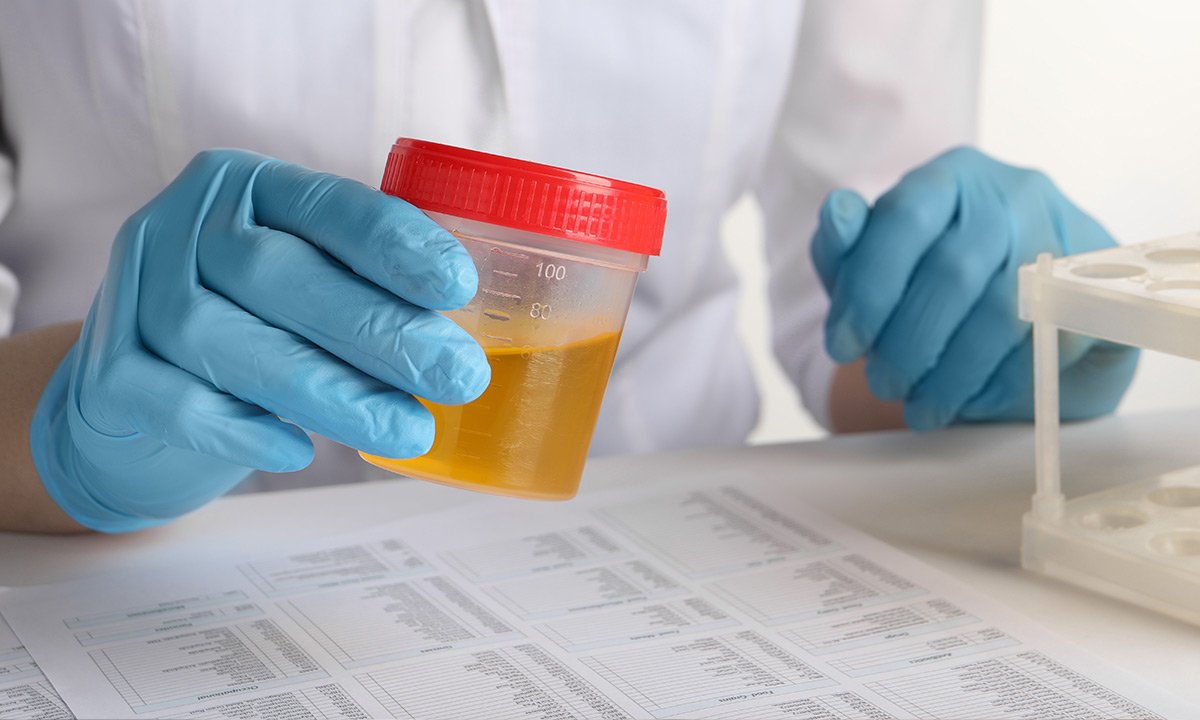 Datcs DOT compliance drug testing